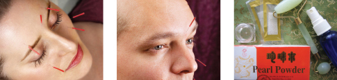 Cosmetic & Facial Rejuvenation Acupuncture in Los Angeles